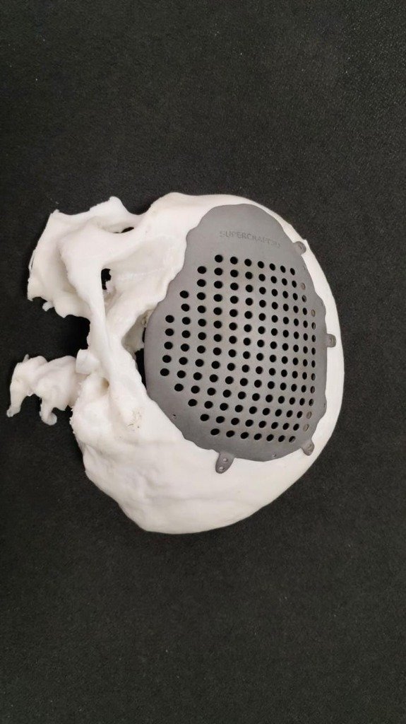 3D Printed Model