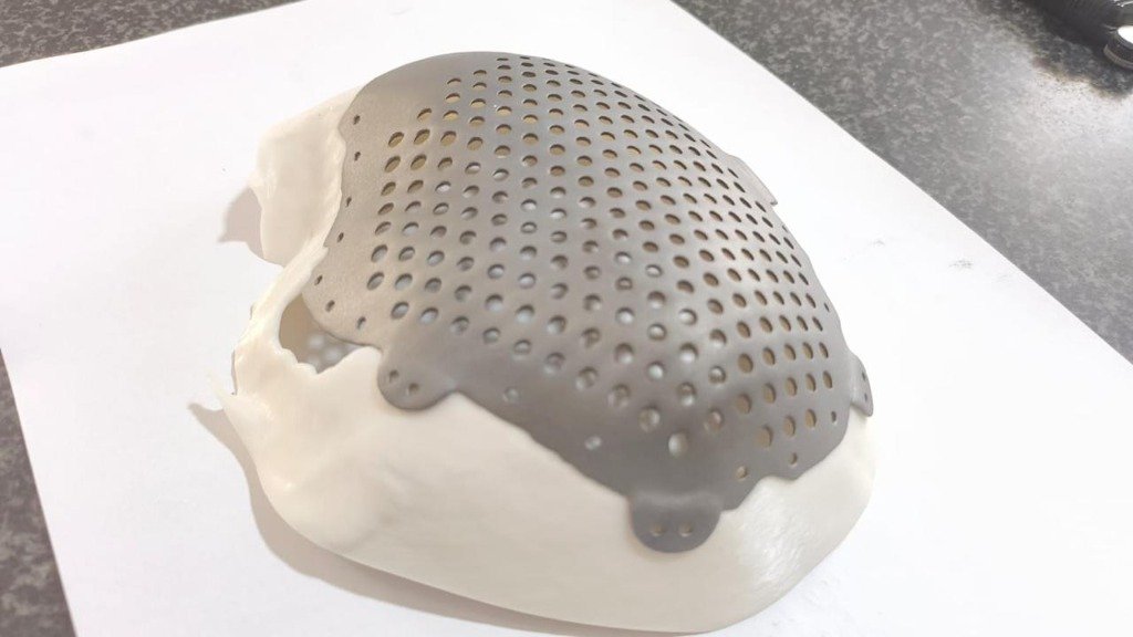 3D Printed Cranial Model Side